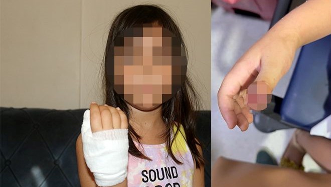 anaokulunda korkunc olay dort yasindaki cocugun parmagi koptu CCwOurr4